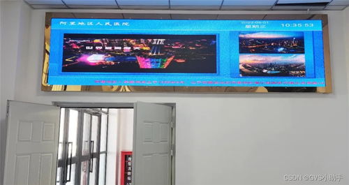 GVS視聲挺進(jìn)西藏，為阿里地區(qū)人民醫(yī)院打造全時(shí)高效智慧醫(yī)療體驗(yàn)